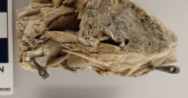 "Is Barium the Secret to Better Health Revealed?"  Barite mineral benefits, Barium CT scan preparation, Leverett Massachusetts geology