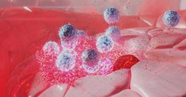 "Revolutionary Therapy Doubles Survival for AML Patients!"  natural killer cell therapy, acute myeloid leukemia treatment, cancer immunotherapy advancements
