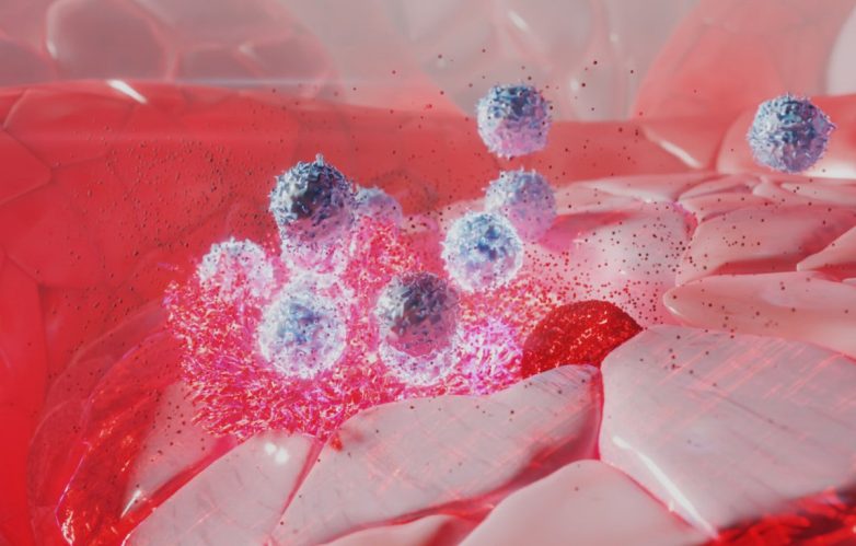"Revolutionary Therapy Doubles Survival for AML Patients!" natural killer cell therapy, acute myeloid leukemia treatment, cancer immunotherapy advancements