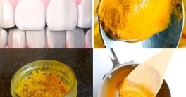 "Swap Pills for Lemon Water: 13 Health Secrets!"  lemon water health benefits, natural remedies for wellness, citrus detox drinks
