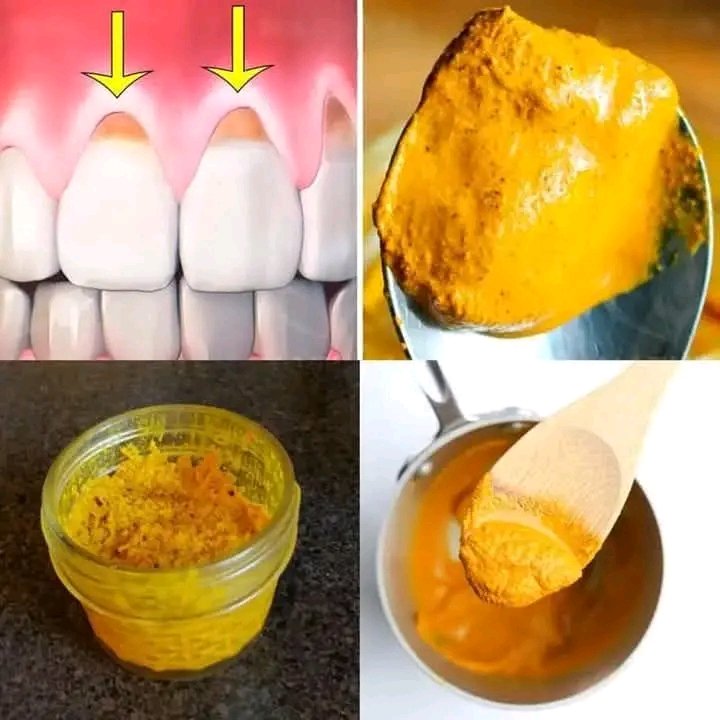 "Swap Pills for Lemon Water: 13 Health Secrets!" lemon water health benefits, natural remedies for wellness, citrus detox drinks